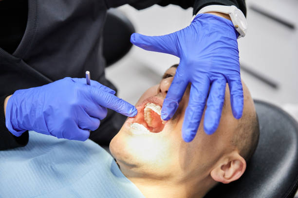Best Knocked-Out Tooth Emergency  in Rogersville, TN